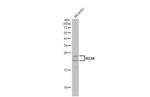 RGS4 Antibody in Western Blot (WB)