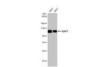 TRIM28 Antibody in Western Blot (WB)