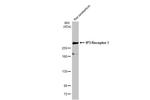 IP3 Receptor 1 Antibody in Western Blot (WB)