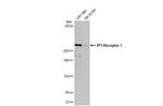 IP3 Receptor 1 Antibody in Western Blot (WB)