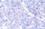 GRK2 Antibody in Immunohistochemistry (Paraffin) (IHC (P))