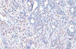 ADAM17 Antibody in Immunohistochemistry (Paraffin) (IHC (P))