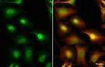 IKK gamma Antibody in Immunocytochemistry (ICC/IF)