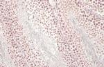 U2AF2 Antibody in Immunohistochemistry (Paraffin) (IHC (P))