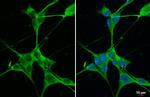 B-Raf Antibody in Immunocytochemistry (ICC/IF)