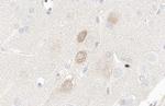 PIK3C2A Antibody in Immunohistochemistry (Paraffin) (IHC (P))