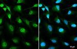 OGT Antibody in Immunocytochemistry (ICC/IF)