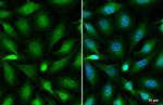 OGT Antibody in Immunocytochemistry (ICC/IF)