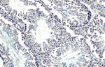 SETDB1 Antibody in Immunohistochemistry (Paraffin) (IHC (P))