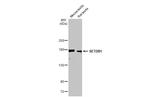 SETDB1 Antibody in Western Blot (WB)