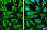 SOD1 Antibody in Immunocytochemistry (ICC/IF)