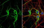 MAP2 Antibody in Immunocytochemistry (ICC/IF)