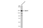 SNAP91 Antibody in Western Blot (WB)