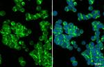 CD81 Antibody in Immunocytochemistry (ICC/IF)