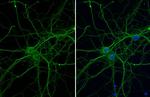 Beta III Tubulin Antibody in Immunocytochemistry (ICC/IF)