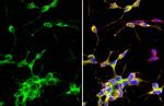 Beta III Tubulin Antibody in Immunocytochemistry (ICC/IF)