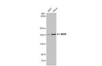 WRN Antibody in Western Blot (WB)