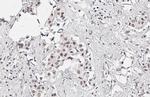 KDM6A Antibody in Immunohistochemistry (Paraffin) (IHC (P))