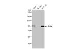 B-Raf Antibody in Western Blot (WB)