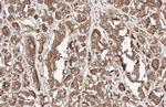 beta Catenin Antibody in Immunohistochemistry (Paraffin) (IHC (P))