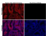 beta Catenin Antibody in Immunohistochemistry (Paraffin) (IHC (P))