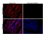 beta Catenin Antibody in Immunohistochemistry (Paraffin) (IHC (P))