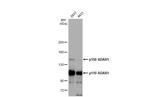 ADAR1 Antibody in Western Blot (WB)