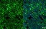 BTK Antibody in Immunocytochemistry (ICC/IF)