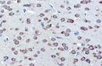 GRP78 Antibody in Immunohistochemistry (Paraffin) (IHC (P))