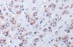 GRP78 Antibody in Immunohistochemistry (Paraffin) (IHC (P))