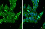 Transthyretin Antibody in Immunocytochemistry (ICC/IF)