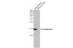 Transthyretin Antibody in Western Blot (WB)