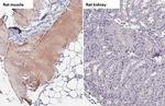 TRIM72 Antibody in Immunohistochemistry (Paraffin) (IHC (P))