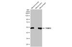 TRIM72 Antibody in Western Blot (WB)