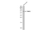 TRIM72 Antibody in Western Blot (WB)