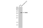 TRIM72 Antibody in Western Blot (WB)