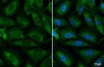 YTHDC2 Antibody in Immunocytochemistry (ICC/IF)