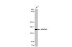 YTHDC2 Antibody in Western Blot (WB)