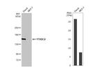 YTHDC2 Antibody in Western Blot (WB)