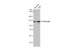 Vinculin Antibody in Western Blot (WB)