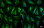 ZC3HAV1 Antibody in Immunocytochemistry (ICC/IF)