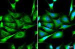 ZC3HAV1 Antibody in Immunocytochemistry (ICC/IF)