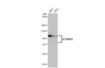 ZC3HAV1 Antibody in Western Blot (WB)