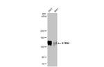 Ataxin 2 Antibody in Western Blot (WB)