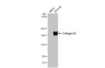 Collagen III Antibody in Western Blot (WB)