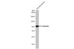 Gelsolin Antibody in Western Blot (WB)