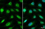 UNC84A Antibody in Immunocytochemistry (ICC/IF)