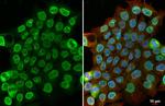 UNC84A Antibody in Immunocytochemistry (ICC/IF)