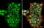 UNC84A Antibody in Immunocytochemistry (ICC/IF)