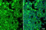 FCGR2B Antibody in Immunocytochemistry (ICC/IF)